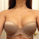 Pre-op with strapless bra