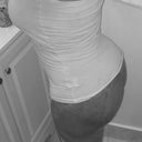 3 days post op no garment on!