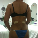 4 weeks post op
