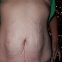Close up, showing skin folds around bb and stretch marks.