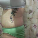 ledt side 3 weeks po today