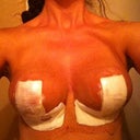 Day 1 - swollen and sore but wow :)