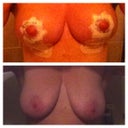 Day 13 - the difference so far !