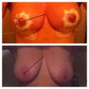 Huge difference so happy !
