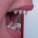 From the side, my lateral incisors look like a second canine. Yuck.