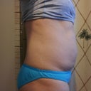 before side view