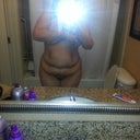 Pre-Surgery (sorry about the nudity)
