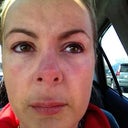right after the procedure in the car