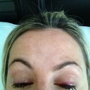 before the nap ...I have ointment on. left eye had a bruising