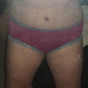 20 days post op, at least that huge apron is gone, im very happy so far