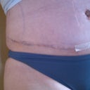 of course there's still plenty of swelling