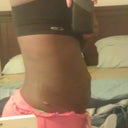 Before Left Side