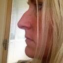 Side view - I feel like I have the profile of a "witch" and will get worse as I grow older!