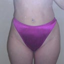 2 months - thighs
3.5 months - waist
