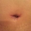 BB still has some stiches in.