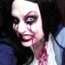 After Botox for migraine, u have to have a sense of humor about these things or u can go crazy!