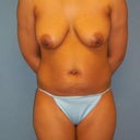 Before pic,I am all stomach!
