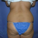 Back / Before