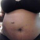 my before pics