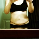 3 week post op.  My right side is more swollen as you can see.  Looks like I have love handles.
