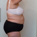 After 9 Zerona Picture August 29, 2012