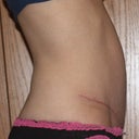 3 months, evening, more swollen