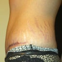 16 weeks side