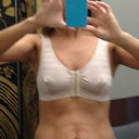 Before Front - in sizer bra at dr office, no padding.