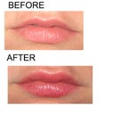 Before and after