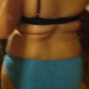 need full liposuction of the back