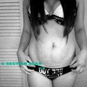 My c-section scar. My tummy tuck scar will actually be right under this one meaning it will be gone.