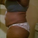 before pic of the belly and booty- Night before the surgery..
