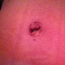 Belly button close up Day 19.  I am very happy!  I always had a horizontal belly button and even was I was super thin in my 20's, it still never looked that good to me.  I never liked it, so I asked Dr Wotowic to please make sure that this one is not "sideways"  :)