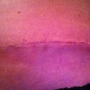 Close up of my scar Day 19.  If it looks this good less than 3 weeks old, I am sure Dr Wotowic is right and I will have an "invisible scar" by the end