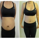 2 months Pre-Op 148pounds / 10 Days Post-Op 135pds
