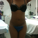 4 weeks post op