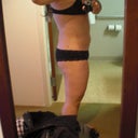 Right side.