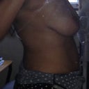 BEFORE SURGERY - I finally found a pre-op pic. They were sooo flat on the top! UGH!!!