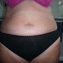 Also on this one too, 2 large freckle points at either side of my tummy button are now both on my cut line and on other pictures that follow