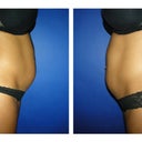 Before Dr pix