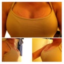 3 weeks post op