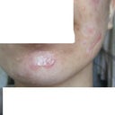 5 month on