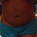 9 days post op, lower abs very swollen, drains removed