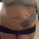 Front view before liposuction of the abdomen