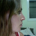 2 months and 1 weeks post-op