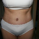 6 weeks