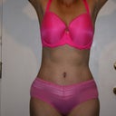 8 Weeks, you can see I'm still swolen inmy right side