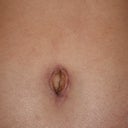 My belly button at 8 weeks