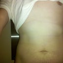 A few weeks after the procedure