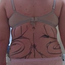 Pre-Op 2